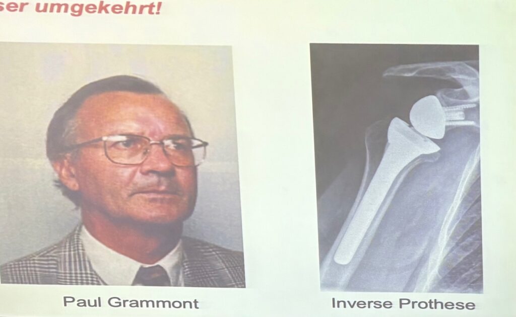 Paul Gremmont Αναστροφή πρόθεση ώμου